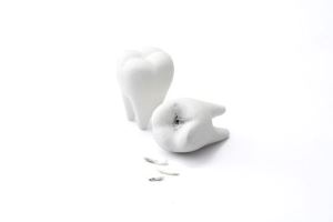 誰的牙??_視覺圖